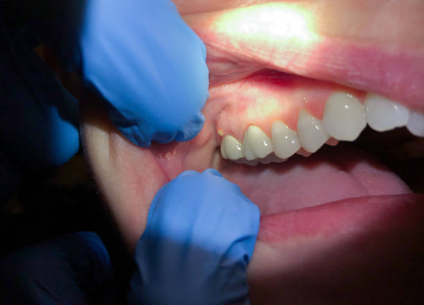 Best Emergency Treatment for Jaw Pain or Injury in Vandenberg Af, CA